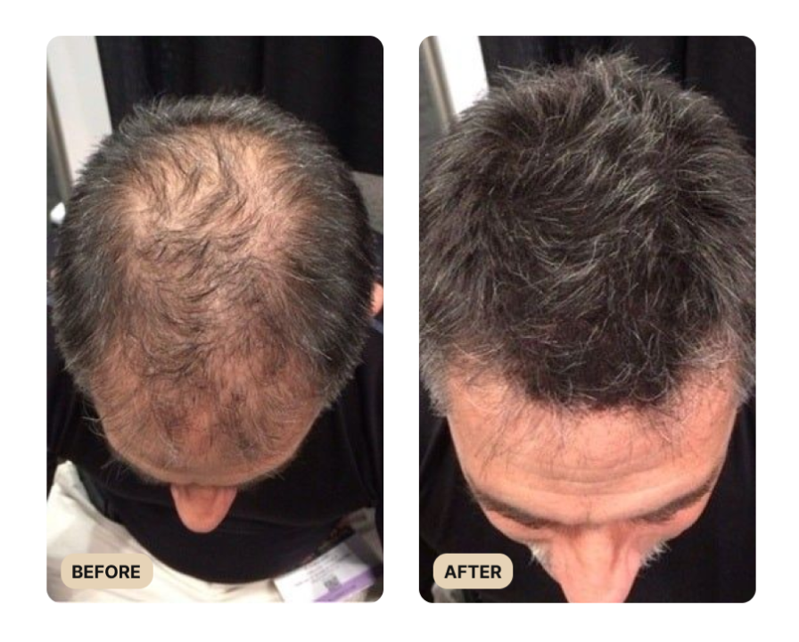 Root Activator Shampoo
