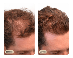 VISIBLE IMPROVEMENTS IN DENSITY & VOLUME
