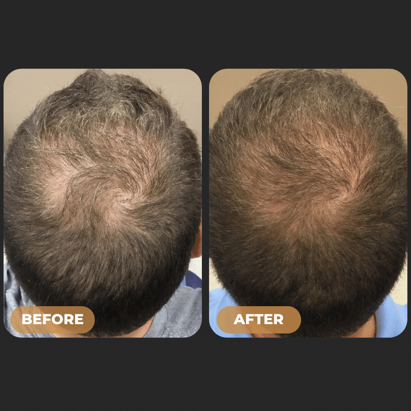 SPARTAN™ - Root Activator Shampoo + Conditioner + FREE Scalp Brush