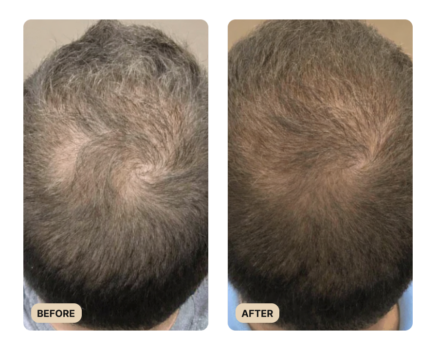 Root Activator Spray