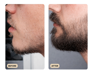 VISIBLE BEARD GROWTH RESULTS