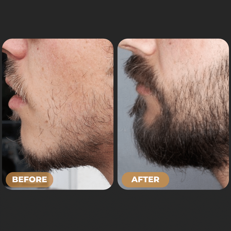 Visible Hair Regrowth Results
