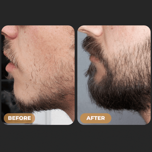 Visible Hair Regrowth Results