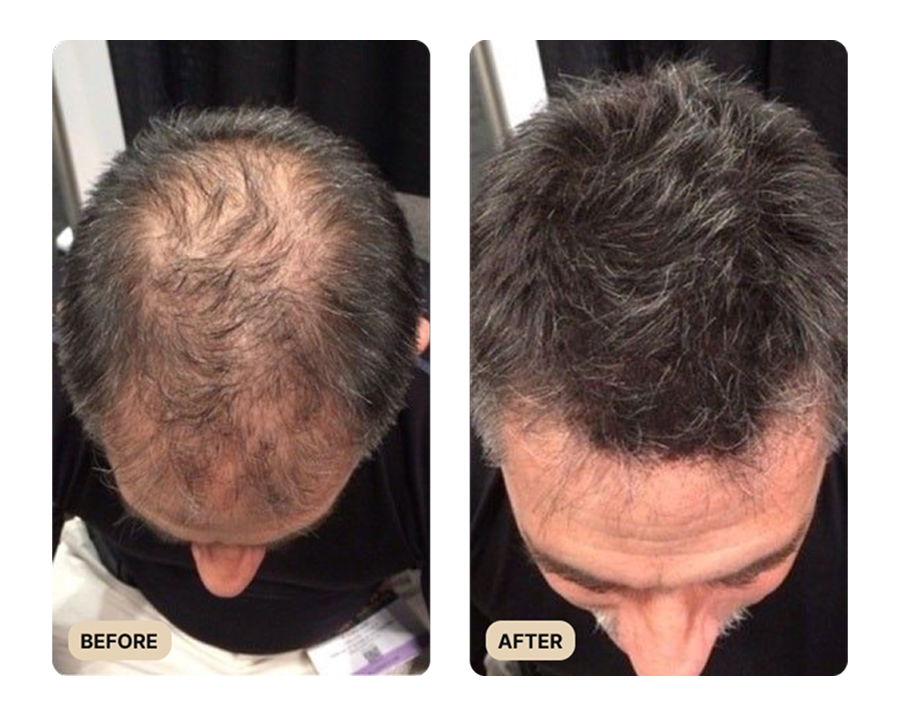 VISIBLE IMPROVEMENTS IN DENSITY & VOLUME