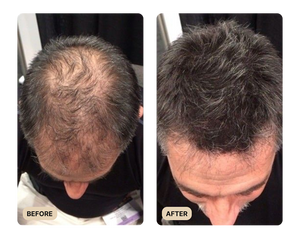 VISIBLE IMPROVEMENTS IN DENSITY & VOLUME