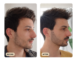 VISIBLE BEARD GROWTH RESULTS