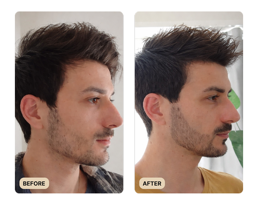 Full Beard Growth System