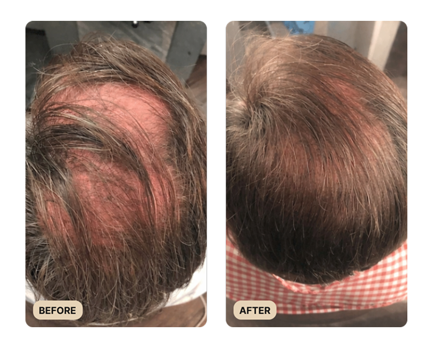 Root Activator Shampoo 2.0