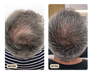VISIBLE IMPROVEMENTS IN DENSITY & VOLUME