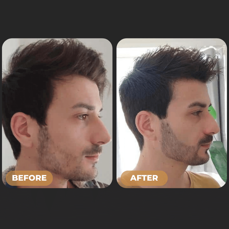 Visible Hair Regrowth Results