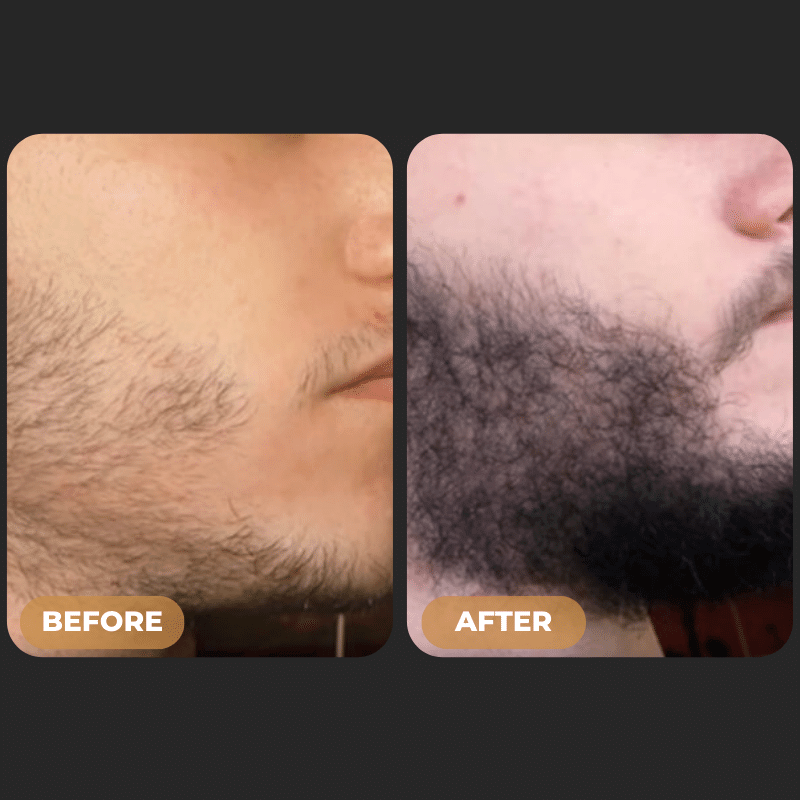 Visible Hair Regrowth Results