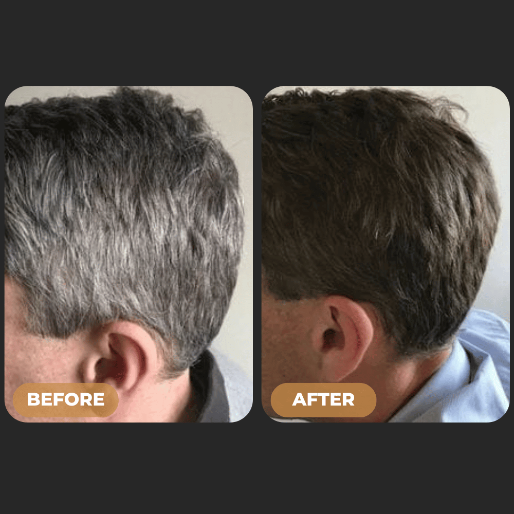 SPARTAN™ Gray Hair Reverse Bar - Reduced Graying with Just 4 Washes a Week*